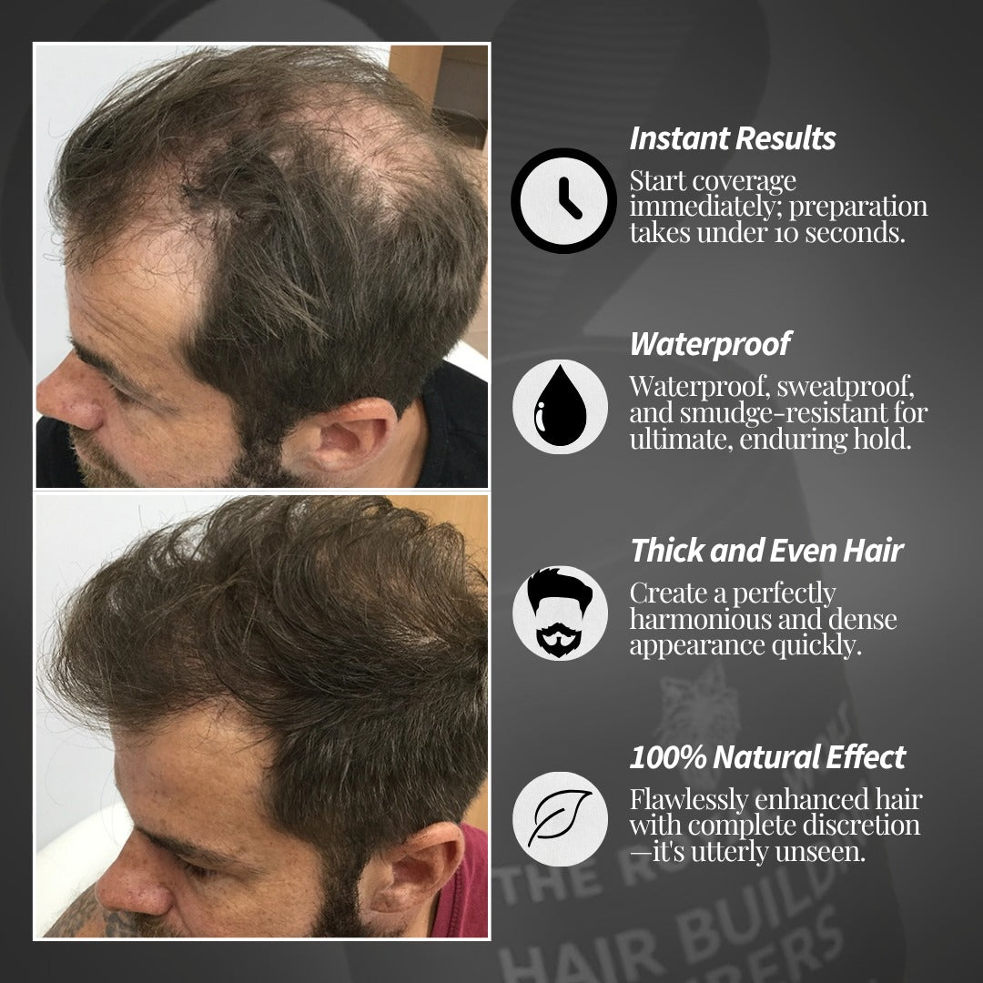 Royal Wolf Premium Hair Building Fibres