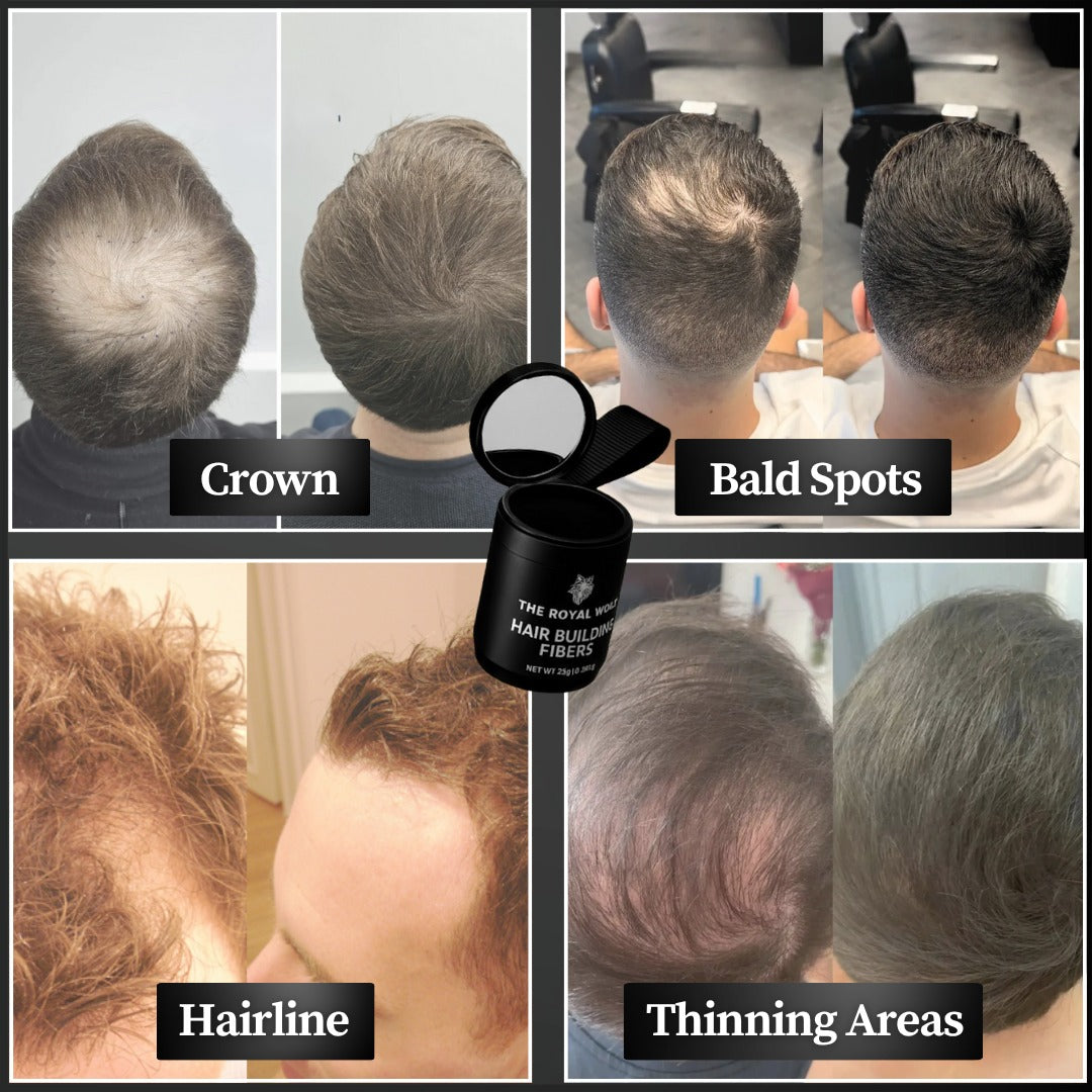 Royal Wolf Premium Hair Building Fibres